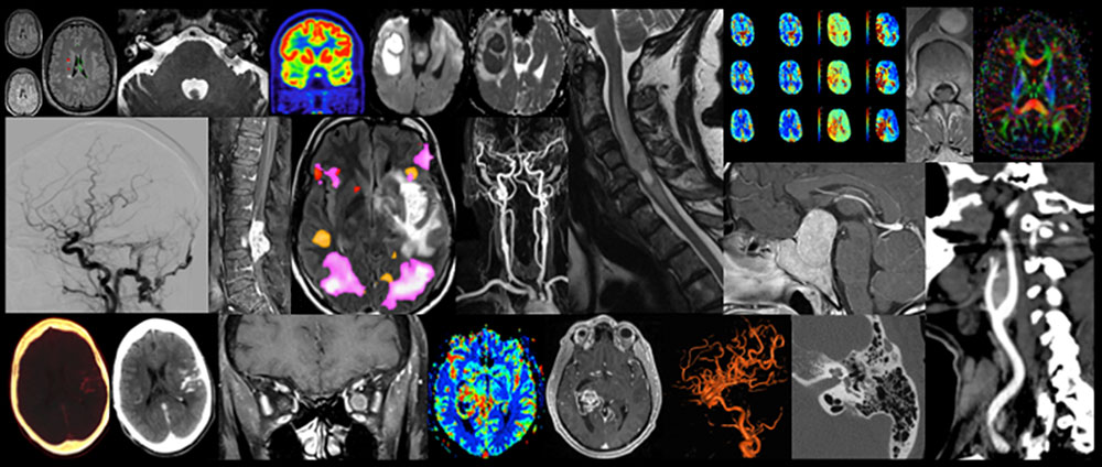 Penn Neuroradiology Fellowship Cases - compilation of scan images